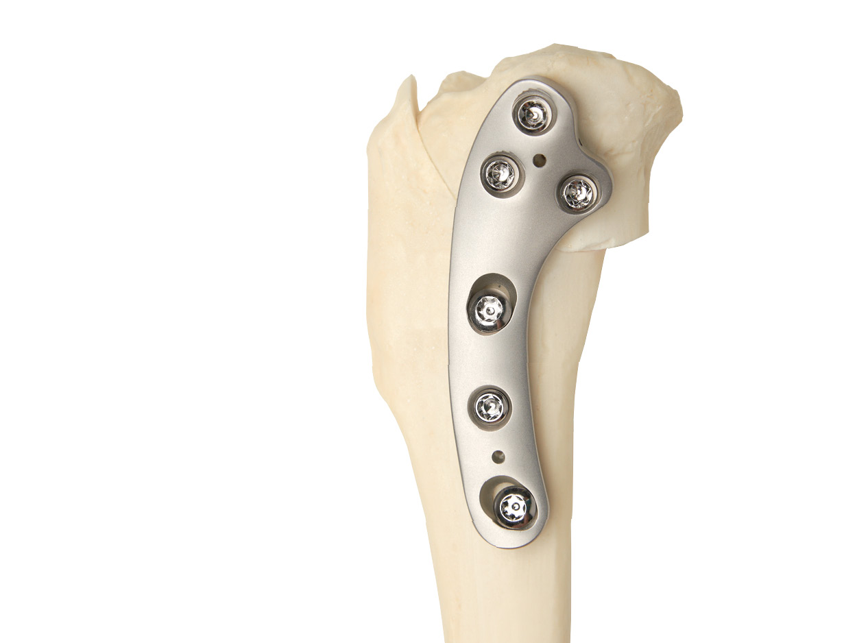 TPLO workshop implant image 600x450px5