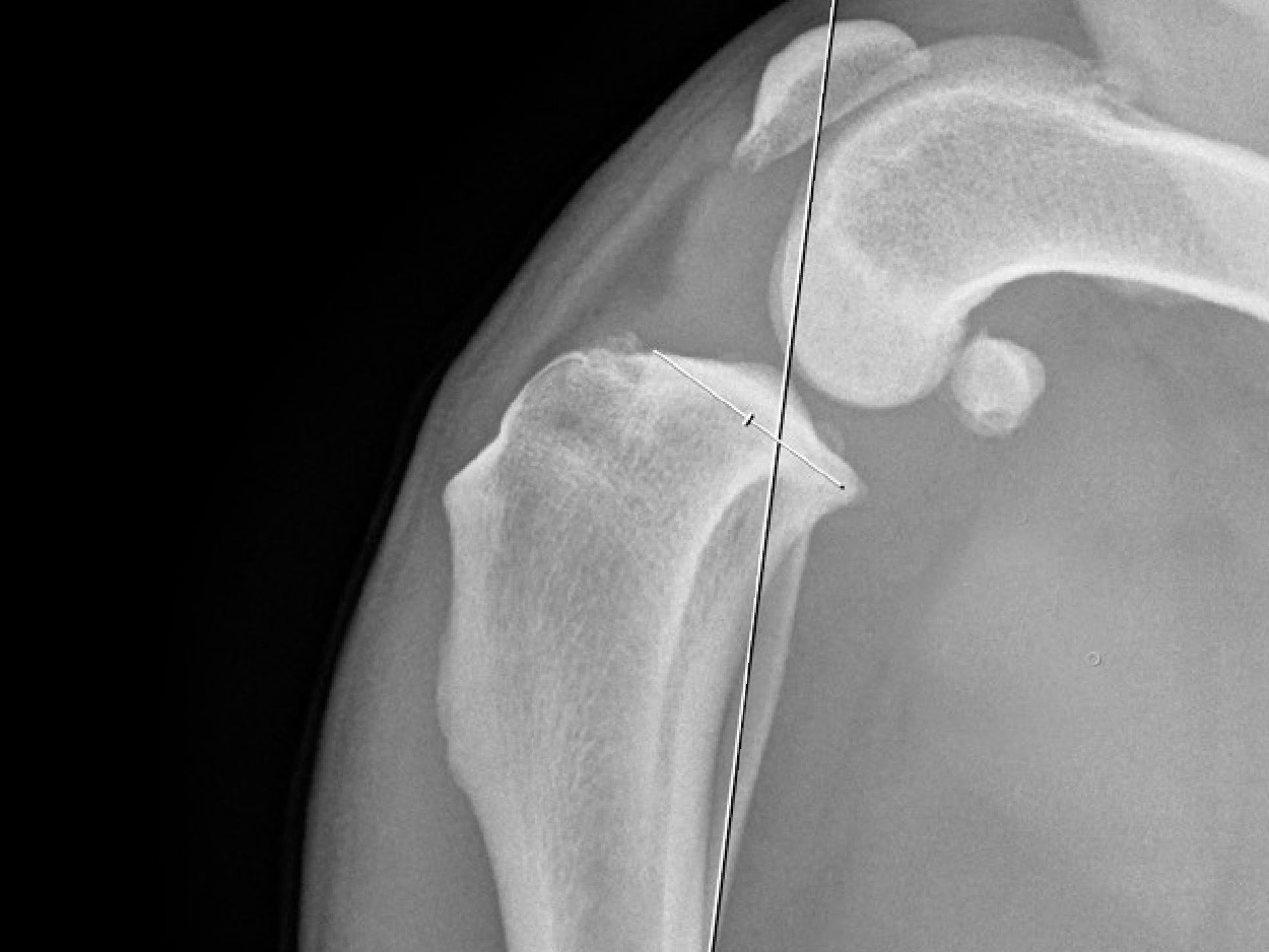 stifle workshop implant image 600x450px4