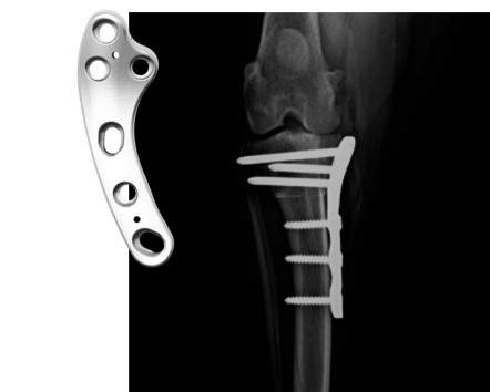 TPLO_LP_agenda_sectiion_advanced