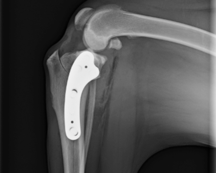 TPLO_LP_agenda_sectiion_intro